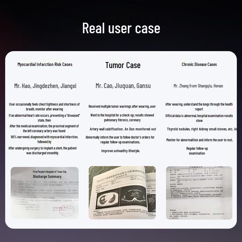 Andon M5 Smart Health Monitoring Watch (CN version)