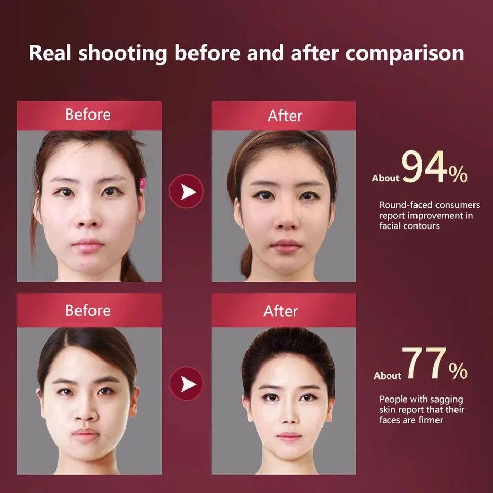 Facial Lifting Device LED Photon Therapy Facial Slimming Vibration Massager Facial Heated Double Chin V Face Vibration Massager