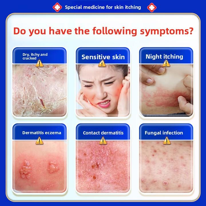 50 г Крем от экземы и грибка, Быстрое облегчение зуда при дерматите и кожных аллергиях, Антисептическая формула