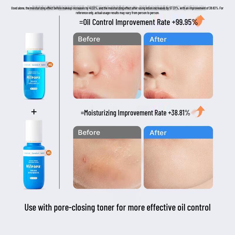 Hi!papa Успокаивающая эссенция-лосьон двойной экстракции