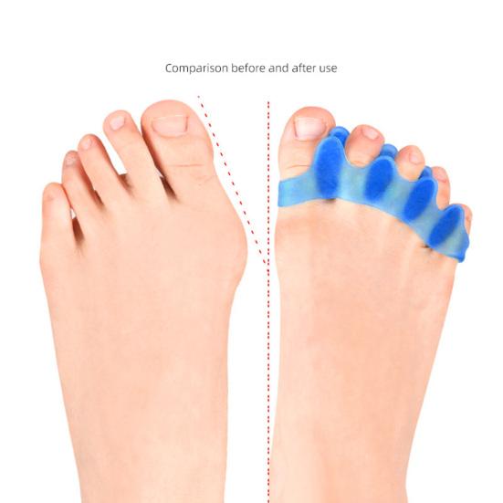 1 Pair Toe Separators for Bunions Toe Spacers Straighteners Toe Stretcher Bunion Corrector for Women Men