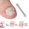 Инструмент для коррекции вросшего ногтя Эластичный пластырь для лечения вросшего ногтя Наклейка для выпрямления Зажим для скоб Инструмент для педикюра