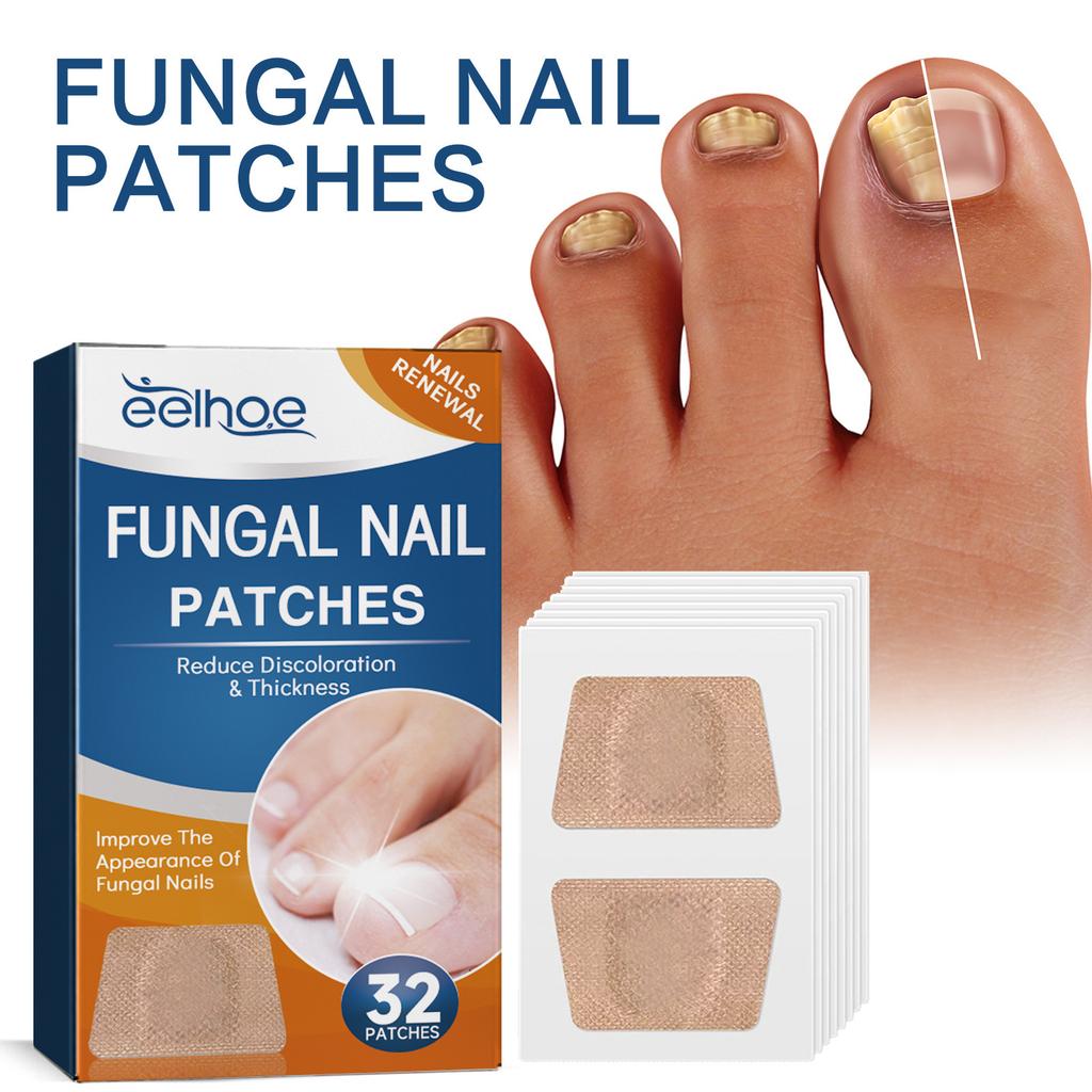 32PCS Foot Nail Repair Patch Grey Fungal Nail Thicken Soft Paronychia Infection Hand Nail Correction Sticker Ingrown Toenail