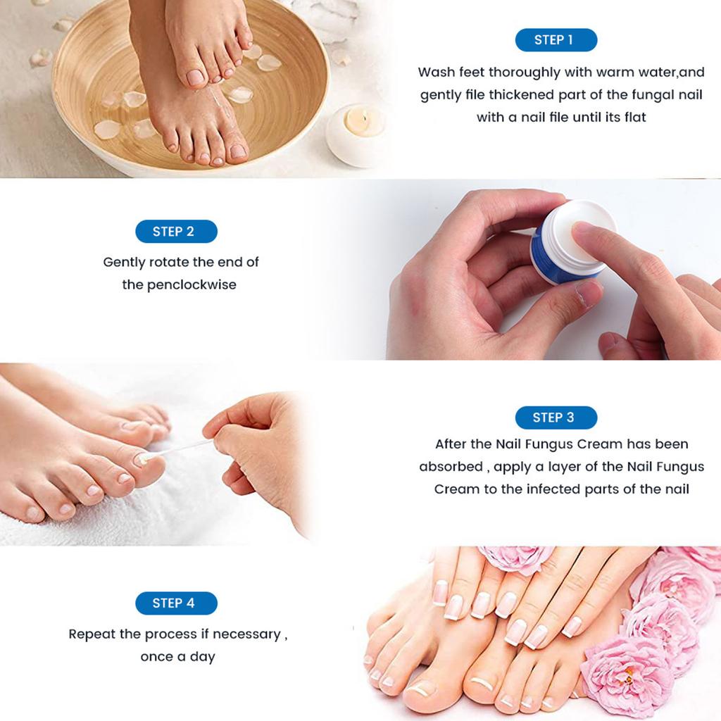 Plaster New Bright Nail Plaster Relieves Onychomycosis And Nail Care