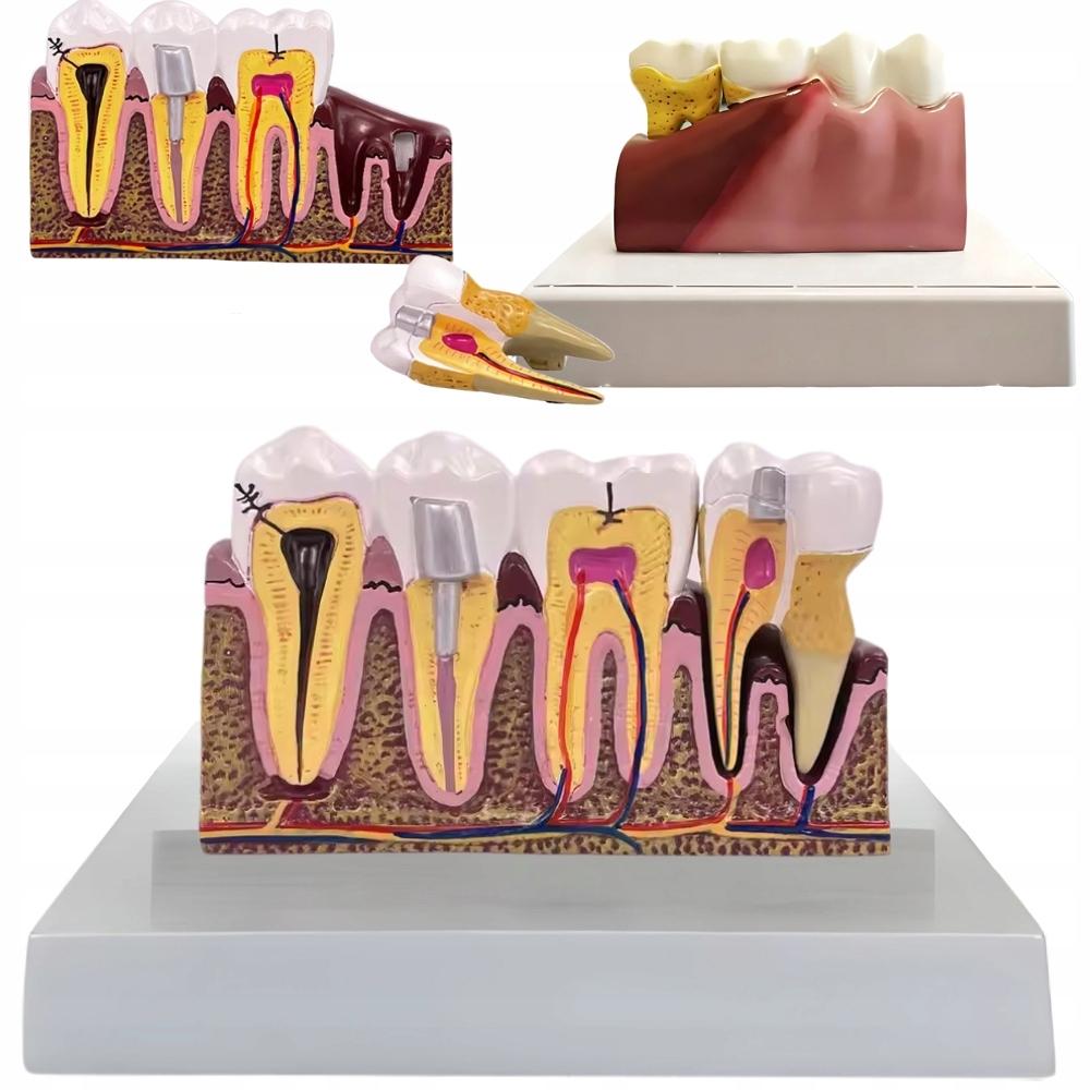 Anatomical Tooth Model (16)