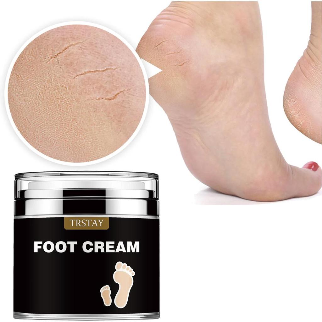 Heel Dry Crack Anti Wrinkle Softening Cream Tightens, Fades, Repairs Fine Lines On Hands and Feet, Eliminates Dead Skin, and Rejuvenates Cracks