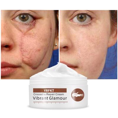 Крокодиловый крем для лечения шрамов и прыщей, уход за лицом, восстанавливающий крем, лечение растяжек, отбеливающий дневной крем