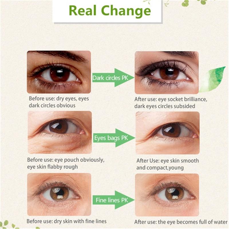 Крем для глаз с красным женьшенем Snail Essence Anti Aging Eye Cream Moisturizer