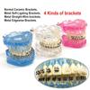 1 Piece Dental Orthodontic Model Patients Communication 4 Kinds Brackets with Ceramic Bracket Metal Self Ligating Brackets