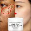 Newest Dark Spots Corrector Cream Whitening Facial Cream Repair Fade Freckles Remove Dark Spots Melanin Remover Brightening Face Cream