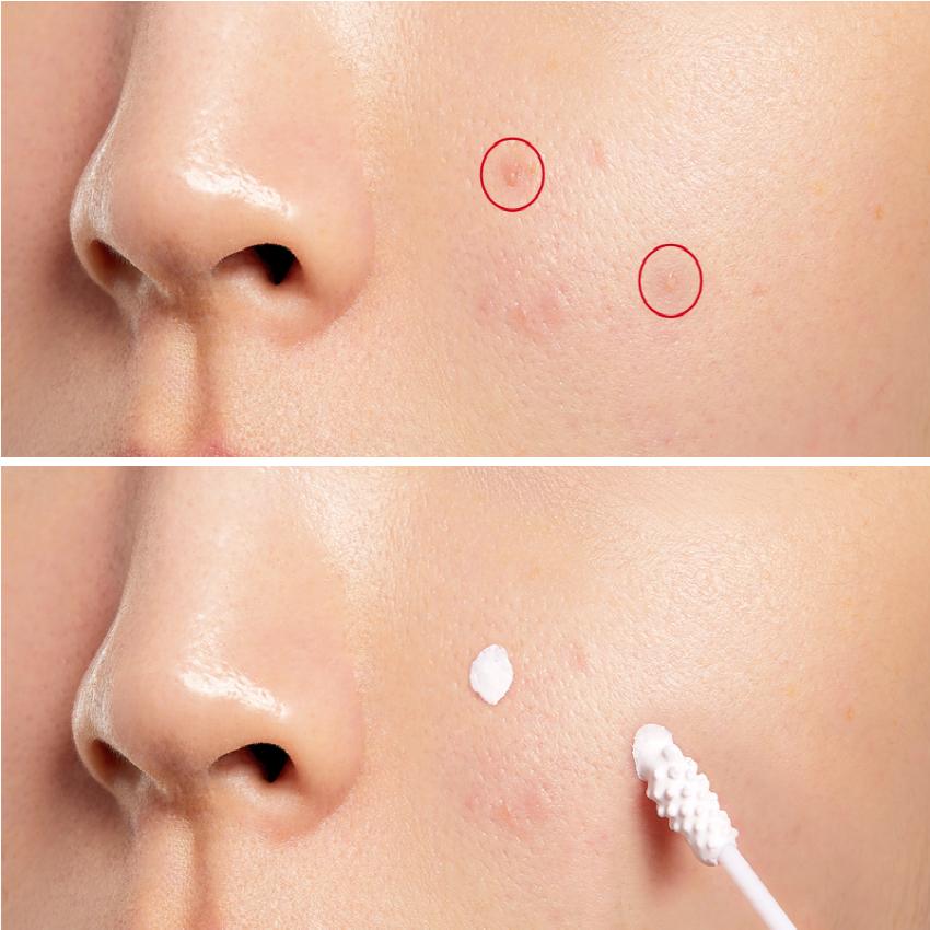 COSRX AC Collection Blemish Spot Drying Lotion 30ml