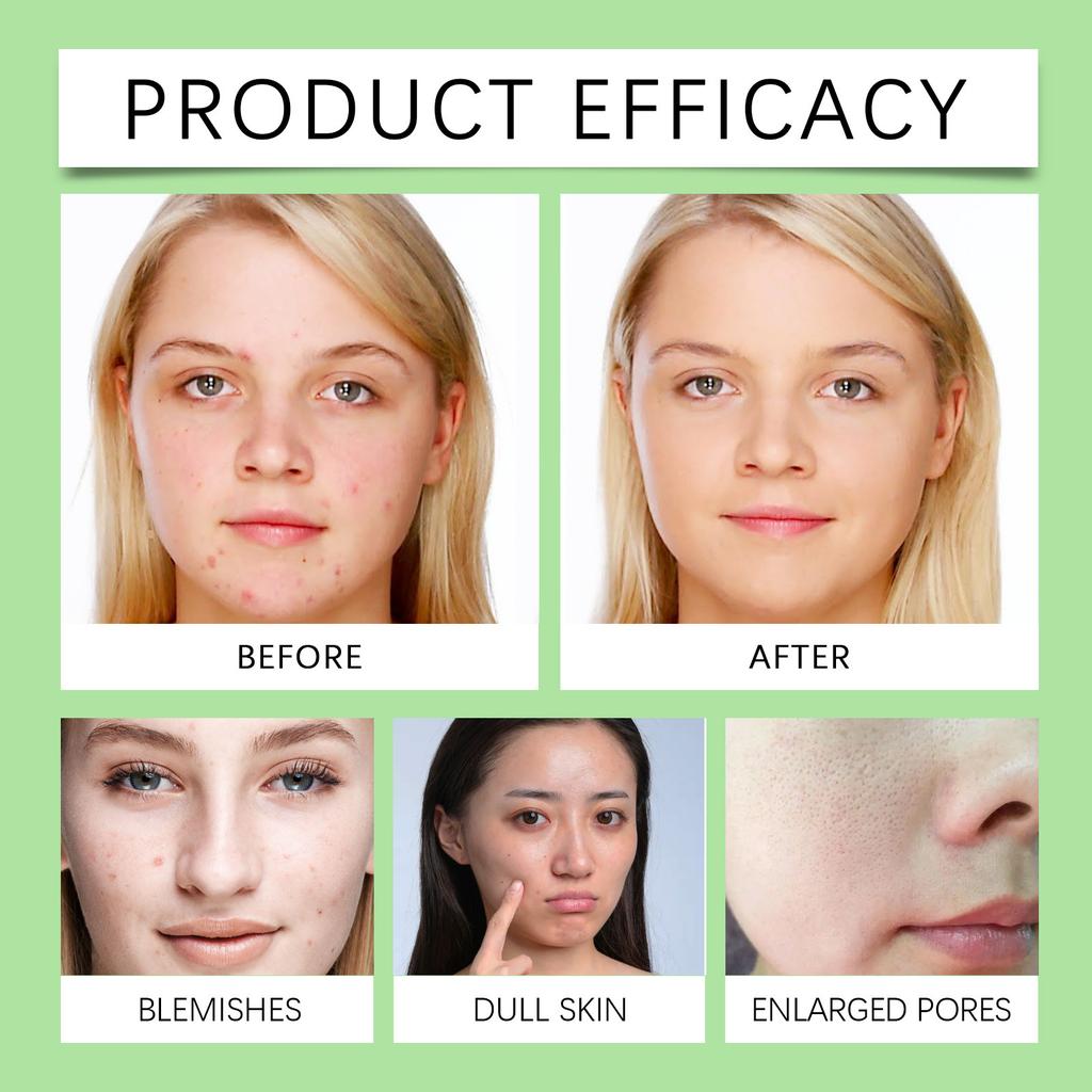 Aloe Foaming Facial Cleanser Moisturizing Gentle Cleansing Pores Refreshing Cleansing 100ml