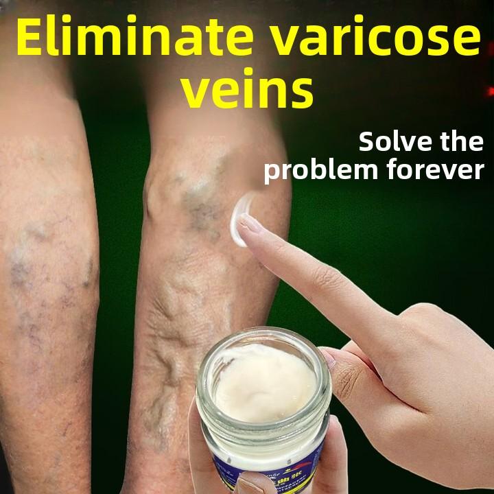 Паста Venoheal Varicose Vein Ease