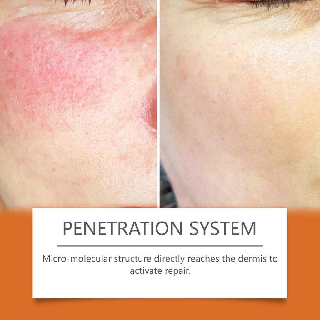 Bee Skin Stick Removal Of Skin Tag Spots, Firming Skin Gentle Ingredients