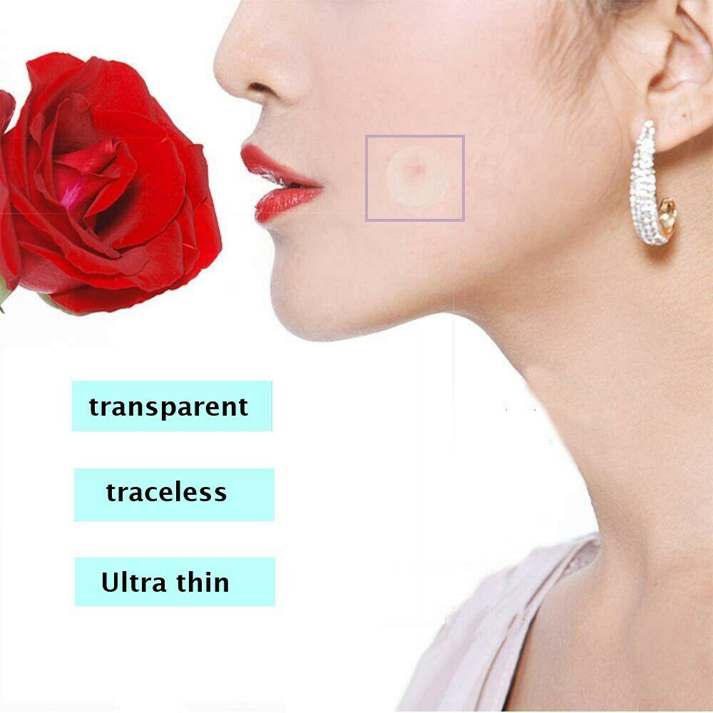 72 шт., лечебные пластыри от прыщей и прыщей, невидимые наклейки для ухода за пятнами на лице