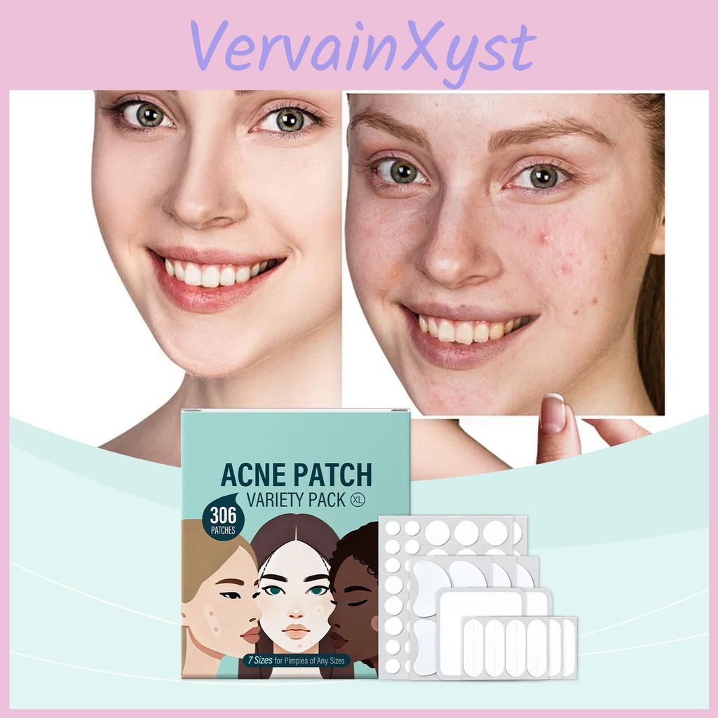 Patch Acne Shapes Variety Packvarious Of Acne Patches Acne Patchesreduce Redness And Swelling Control Oil And Fight Acne306patches