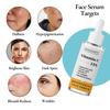 Rosebrite Осветляющая сыворотка для лица с витамином С 15%, с гиалуроновой кислотой, феруловой кислотой, витамином Е, триколлагеном, экстрактом черники Для сияния и осветления