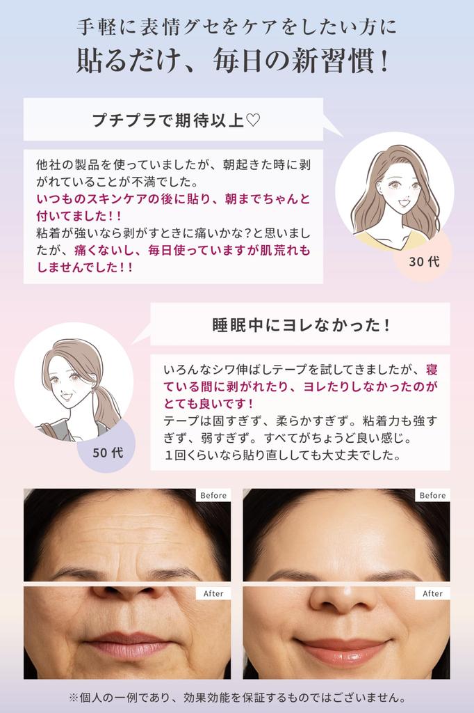 By Beauty Wrinkle Pin Wrinkle Smoothing 48 Large for Nasolabial and Brow and CONYCONY 48 [Supervised Professionals] Tape, Sheets, Capacity, Folds,