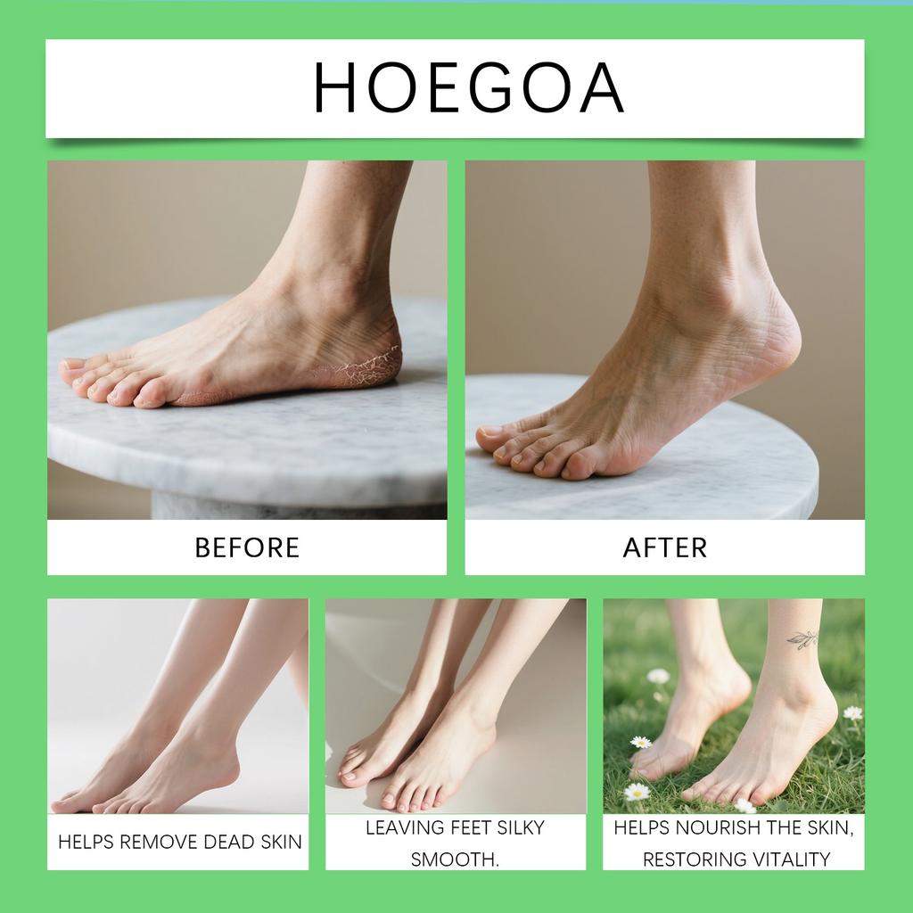 Peele Спрей для мгновенного пилинга стоп, Спрей для пилинга стоп, Мгновенно удаляет омертвевшую кожу, Увлажняет и питает, Отшелушивает сухую, грубую кожу (100мл)