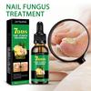 Ginger Nail Care Solution 30ml Nail Care Cuticle Regenerating Oil Preventative Nail Polish Softener for Dead Skin Gel Manicure Care Tool
