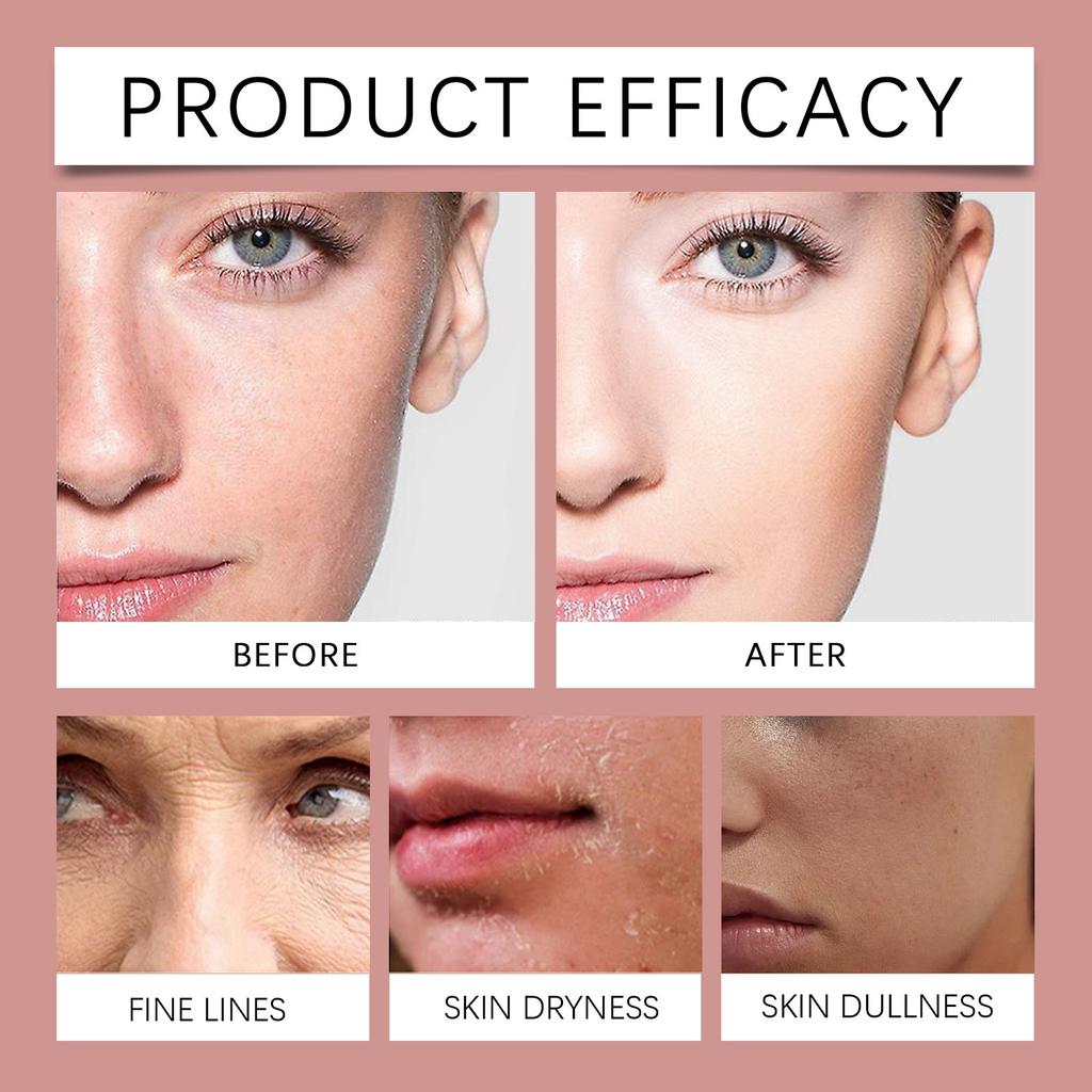 Niacinamide Gel Cream , Facial Moisturizing And Moisturizing Products To Make The Skin Look Healthier,20g