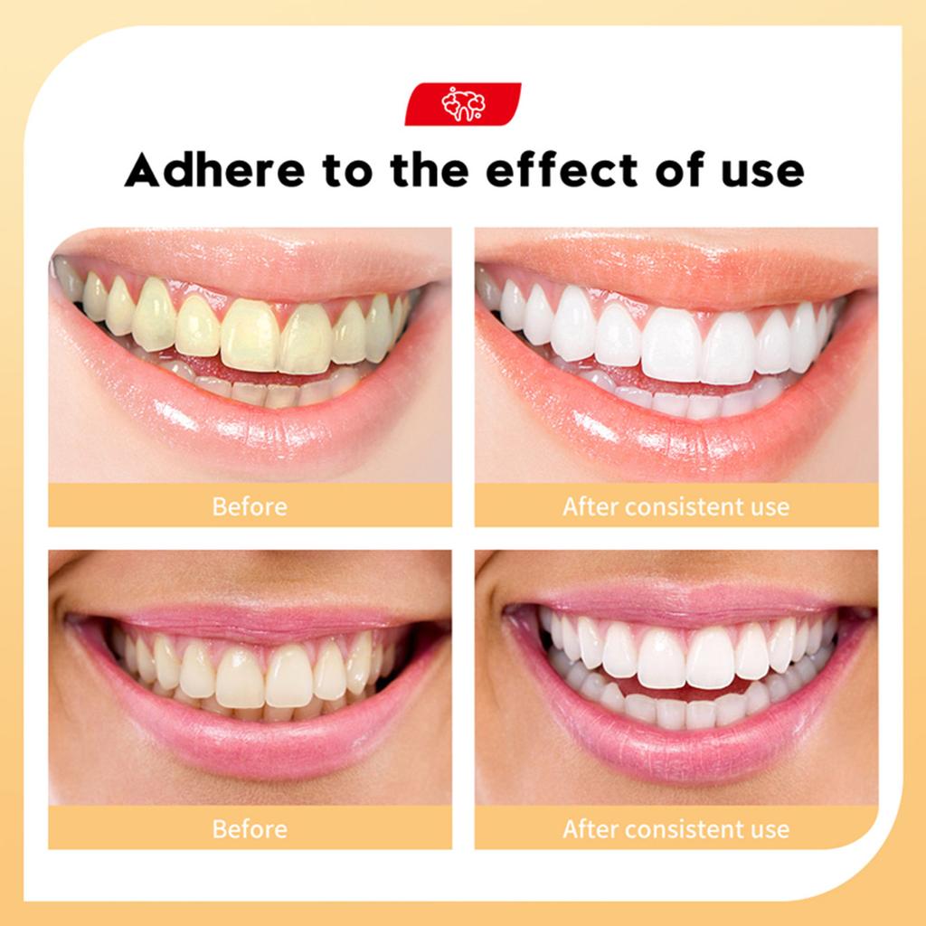 Cleaning Tartar Gum-toothpaste Whitening Toothpaste 100g