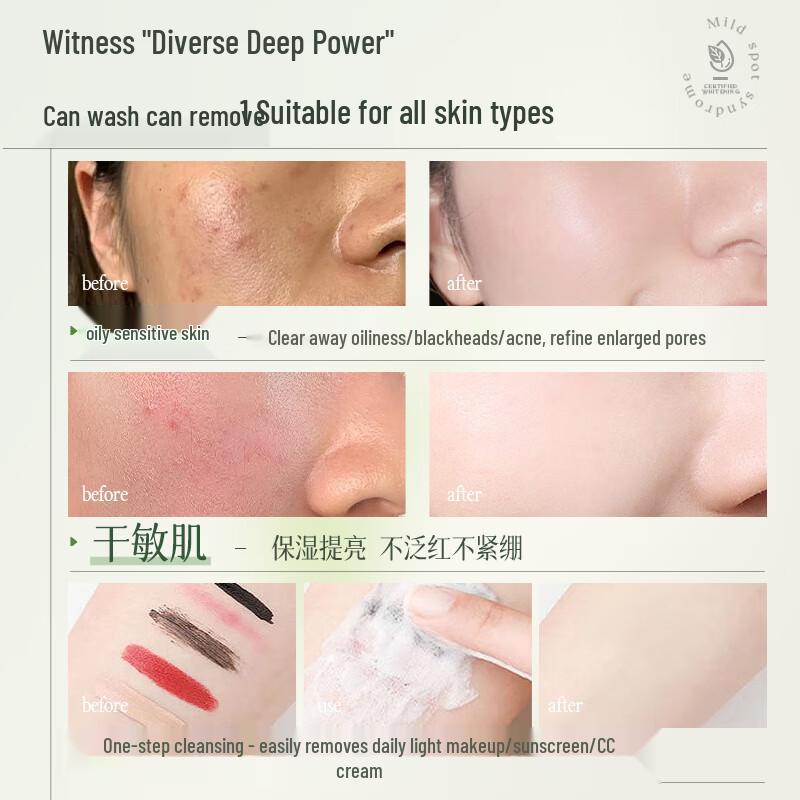 RUYI Подростковый аминокислотный очищающий гель для лица