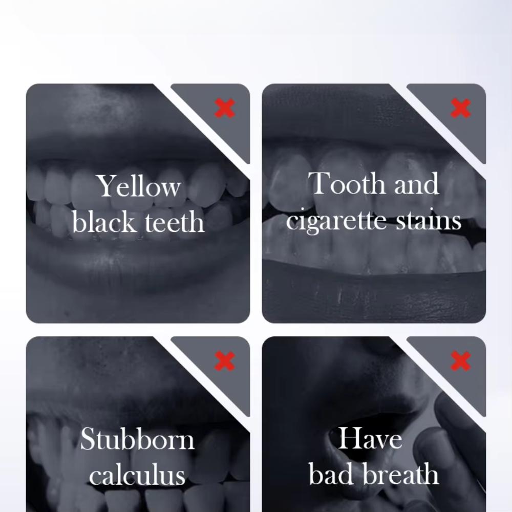 Пробиотическая отбеливающая зубная паста с пищевой содой для удаления желтых пятен на зубах и удаления белых зубов Clean Teeth Fresh Mouth 300 г