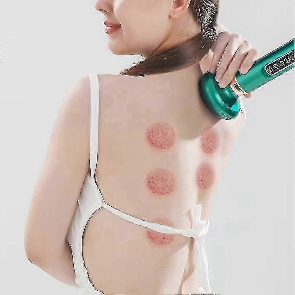 Handheld Anti-Cellulite Massager with 12 Suction Modes for Body Slimming and Skin Tightening,Suitable for Milow Glow Fit and Similar Brands