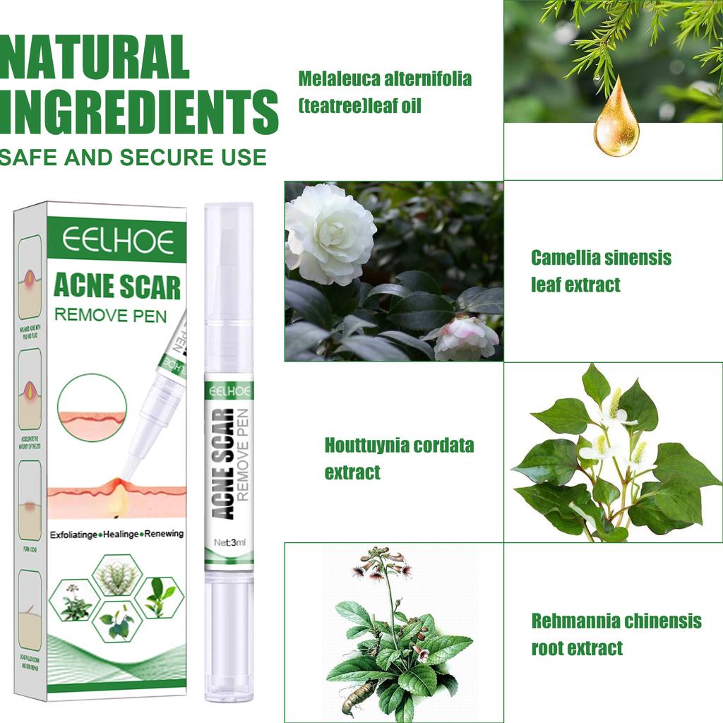 EELHOE Herbal Acne Removal Pen Oil Control Anti-Acne Gel Treatment Acne Mark Skin Care Whitening Eliminate Pimples Facial Cream