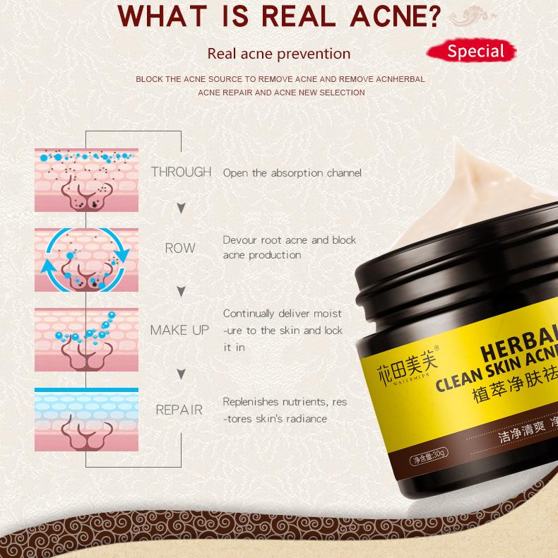 Крем с травами, крем против шрамов от прыщей, крем для лица, контроль жирности, восстанавливающий крем от прыщей, уход за лицом, отбеливающий крем, 30 г