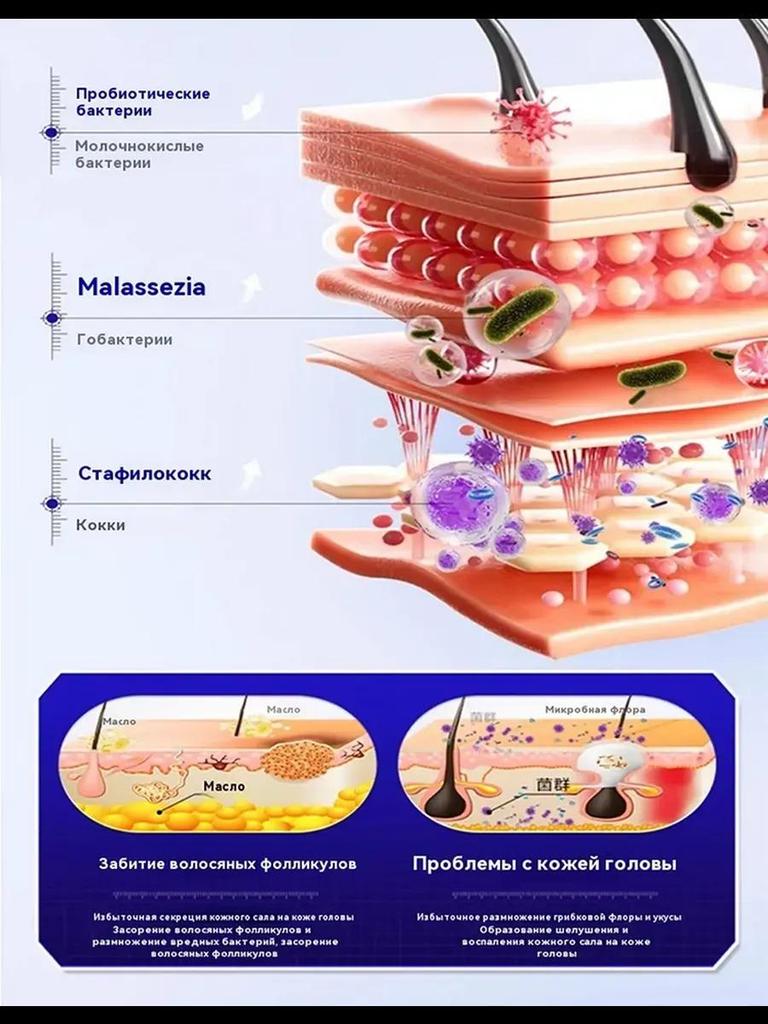 Ringworm Capitis and Scalp Special Spray Fungal Infection Dandruff Itching
