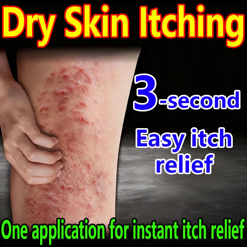 Anti-itching Cream for Itchy, Dry Skin