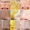 Золотая маска для удаления черных точек, слезная маска, отбеливающая очищающая маска для лица
