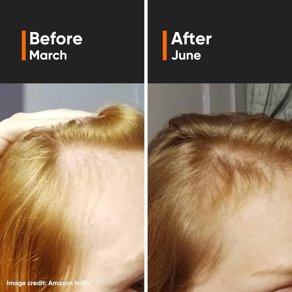 Minimalist Сыворотка для роста волос 30 мл с Capixyl 5%, Redensyl 3%, Procapil 3%, Anagain 3%, Baicapil 4% для мужчин и женщин