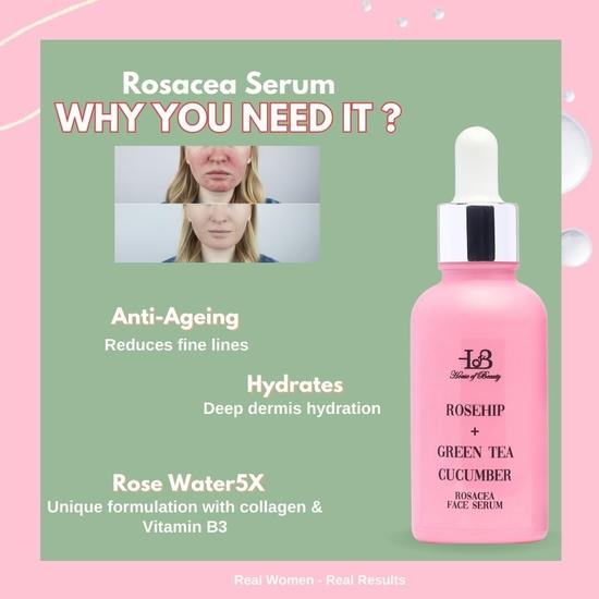 HOUSE OF BEAUTY Сыворотка от розацеи - шиповник, зеленый чай, огурец для лица, чувствительная кожа, покраснения, сухость и растяжение кожи (30мл)