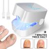 Portable UV Nail Therapy Lamp for Onychomycosis