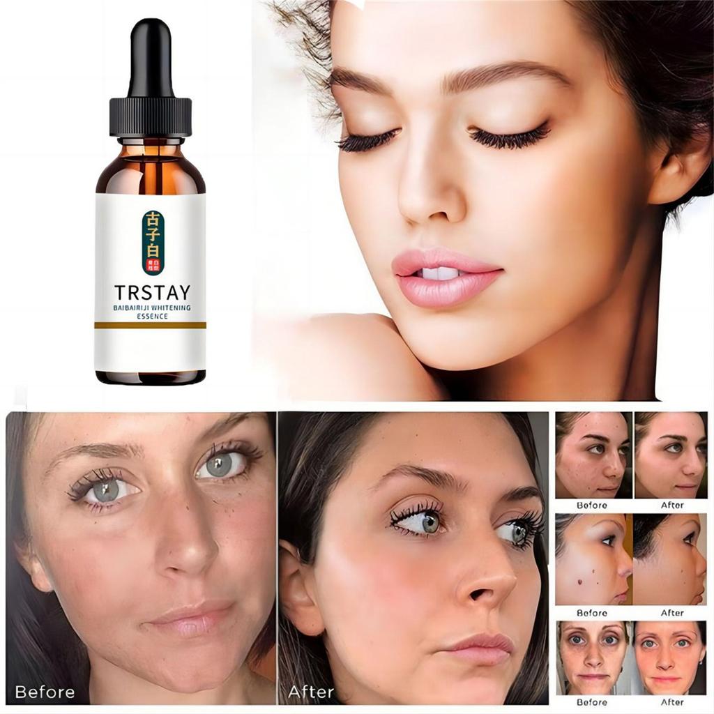 Whitening Freckle Cream Effective Remove Melasma Dark Spots Cream Fade  Moisturize Brighten Smooth Beauty Face Skin Care