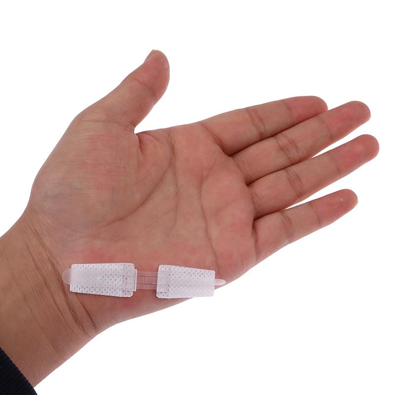 1 шт., пластырь на молнии, безболезненное устройство для закрытия ран, без швов, пластыри для повязки на рану, пластырь для уменьшения швов на молнии