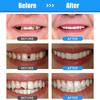 30 мл смоляной клей для восстановления зубов, формирующий зазоры между зубами, твердый временный клей для восстановления зубов, безопасные стоматологические принадлежности