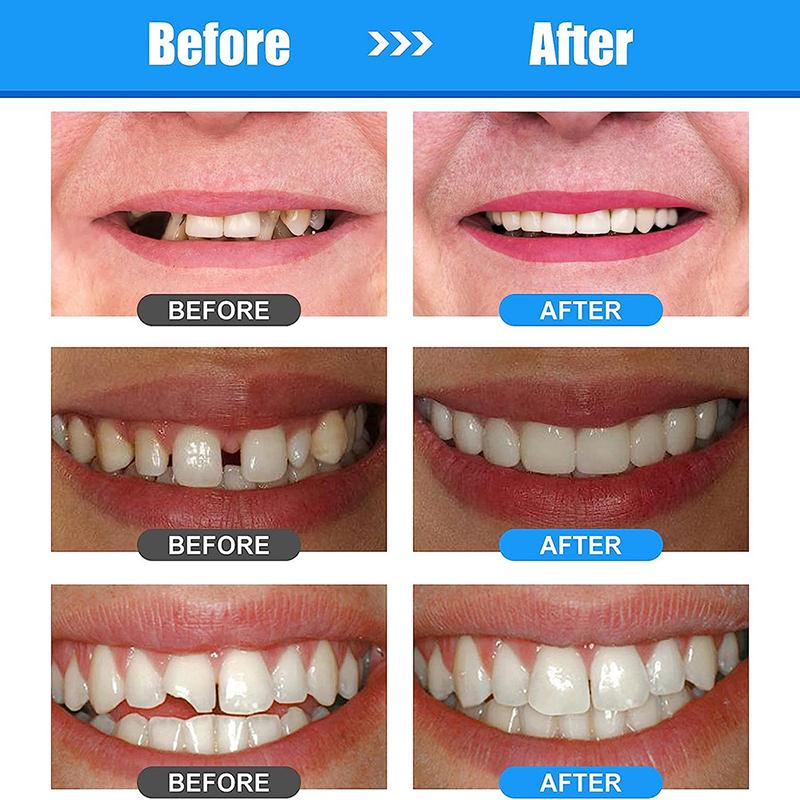 30 мл смоляной клей для восстановления зубов, формирующий зазоры между зубами, твердый временный клей для восстановления зубов, безопасные стоматологические принадлежности