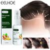 Hair Growth Spray Essential Fast Regrowth Serum Beard Growth Oil Hair Loss Care Beauty Hairline Scalp Treatment for Men Women