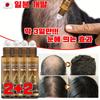 Hair Loss Scalp Hair Essence 10ml, 4 Pieces