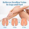Varicose Veins Cream-Improve Blood Circulation-Relief Swelling And Pain-Minimize Varicose Vein & Spider Vein, 50g