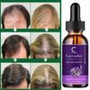 Новые продукты для роста волос, быстрорастущие эфирные масла для волос, косметический уход за волосами, предотвращение выпадения волос, масло для ухода за кожей головы для мужчин и женщин