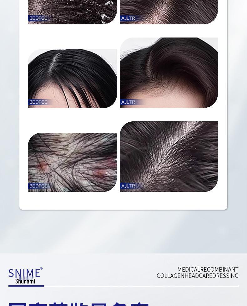 Медицинский шампунь CVKK с коллагеном против перхоти и зуда для лечения себорейного дерматита.