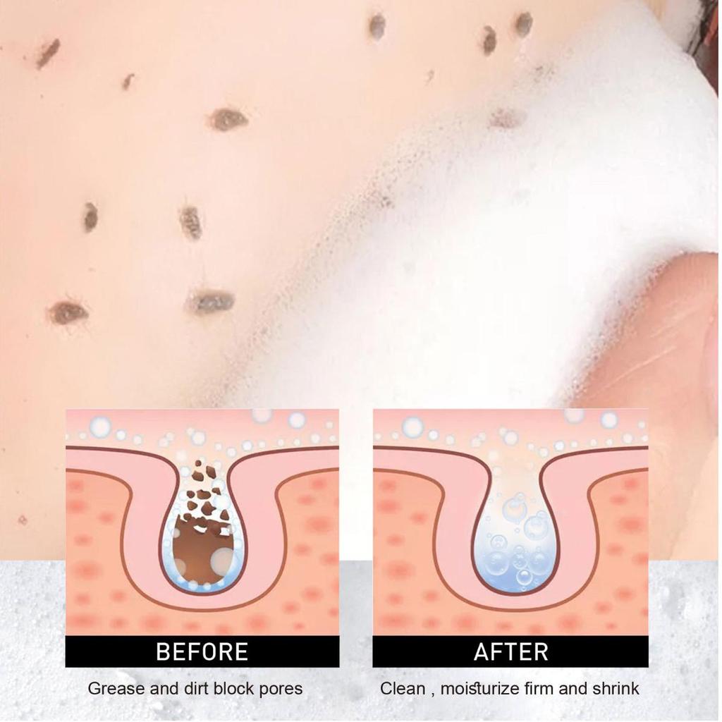 Moisturizing Facial Cleansing Mousse with Hyaluronic Acid for Refreshing and Deep Cleansing