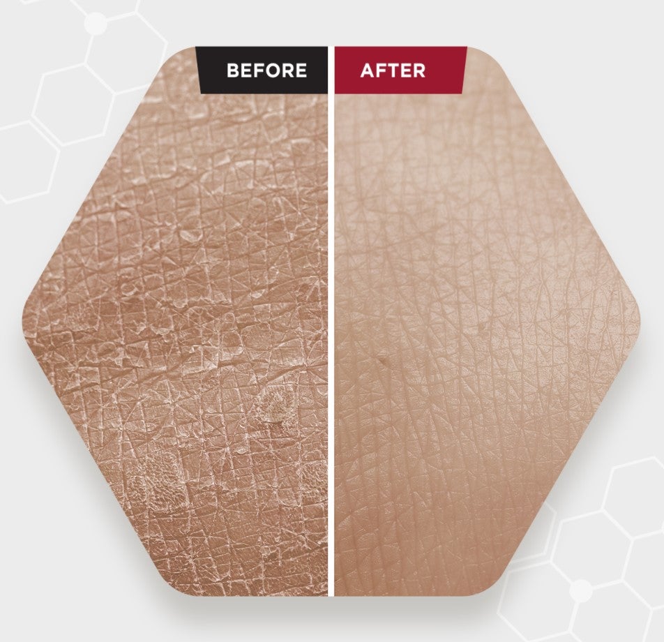 Skin1004 Zombie Beauty Кровавый пилинг 30мл