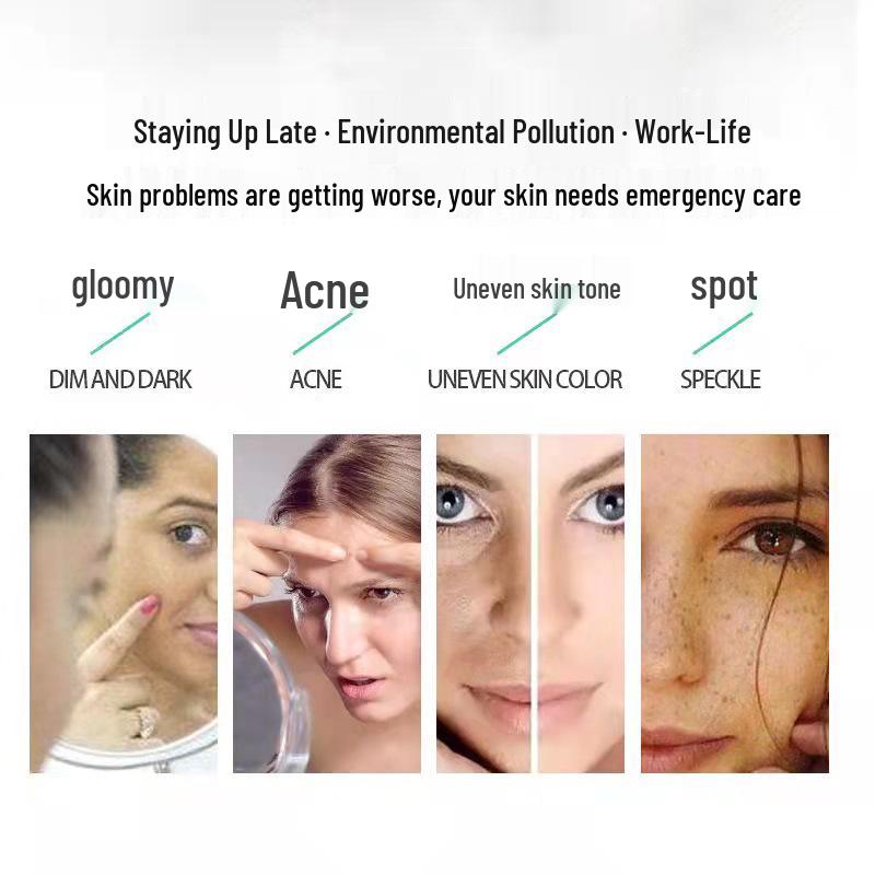 Осветляющий крем для лица с транексамовой кислотой для коррекции мелазмы, пигментных пятен, веснушек и темных пятен