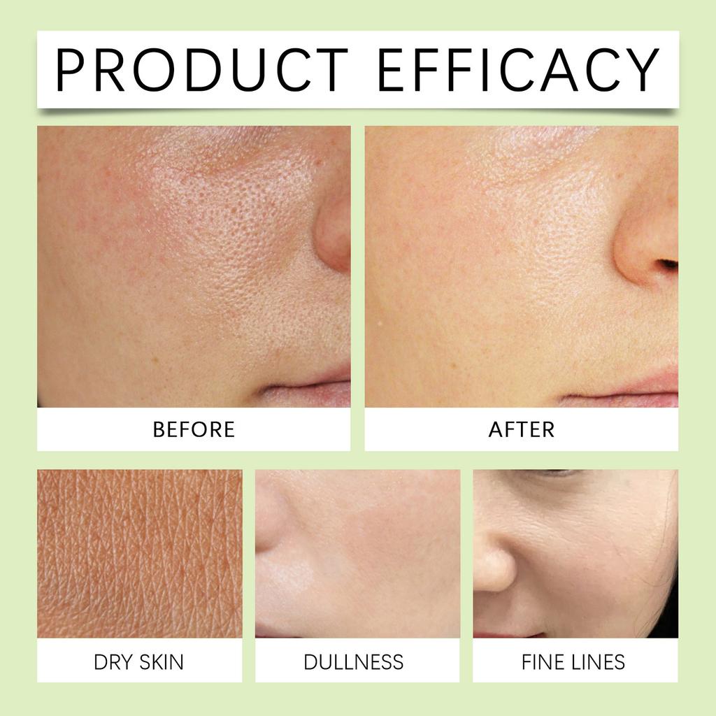 Увлажняющее и осветляющее очищающее средство глубоко очищает лицо и тело, увлажняя, отбеливая и придавая коже красоту, не стягивая ее.